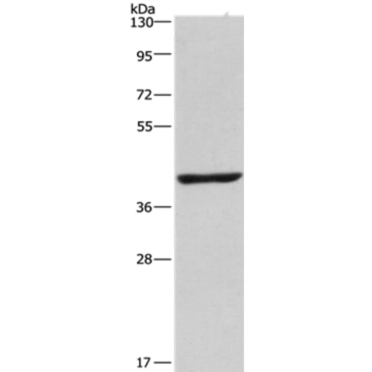 NME7 Antibody from Signalway Antibody (35840) - Antibodies.com