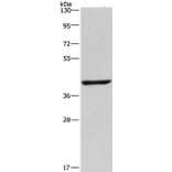 NME7 Antibody from Signalway Antibody (35840) - Antibodies.com