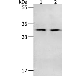 NME6 Antibody from Signalway Antibody (35841) - Antibodies.com