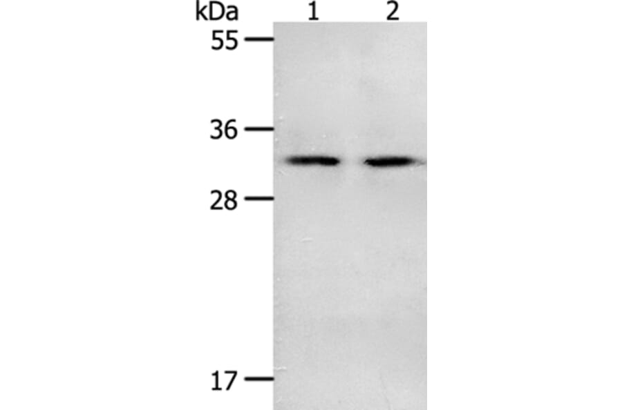NME6 Antibody from Signalway Antibody (35841) - Antibodies.com