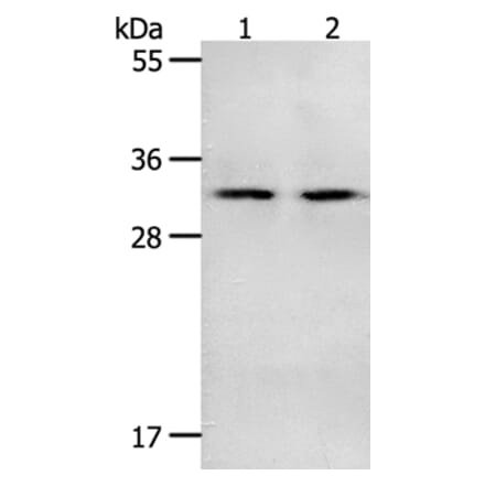 NME6 Antibody from Signalway Antibody (35841) - Antibodies.com