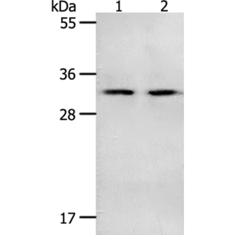 NME6 Antibody from Signalway Antibody (35841) - Antibodies.com