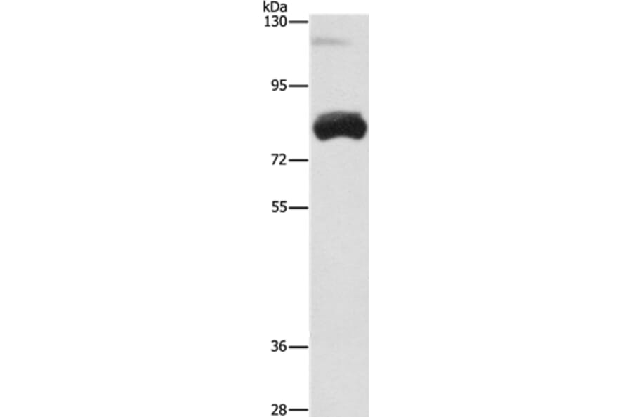 OAS2 Antibody from Signalway Antibody (35848) - Antibodies.com