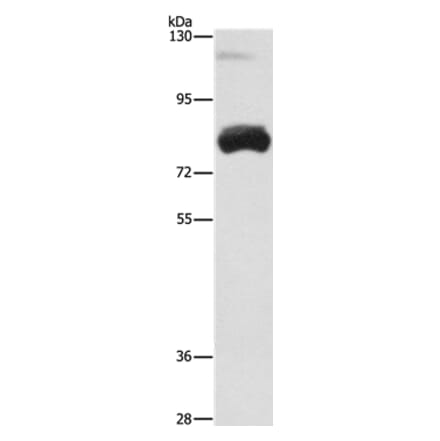 OAS2 Antibody from Signalway Antibody (35848) - Antibodies.com