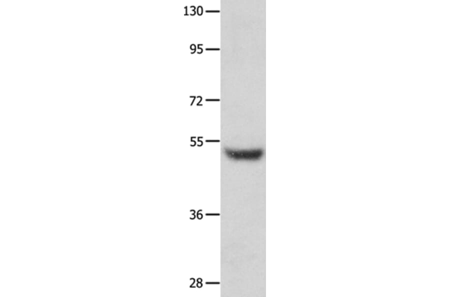 TP73 Antibody from Signalway Antibody (35860) - Antibodies.com