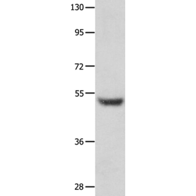 TP73 Antibody from Signalway Antibody (35860) - Antibodies.com