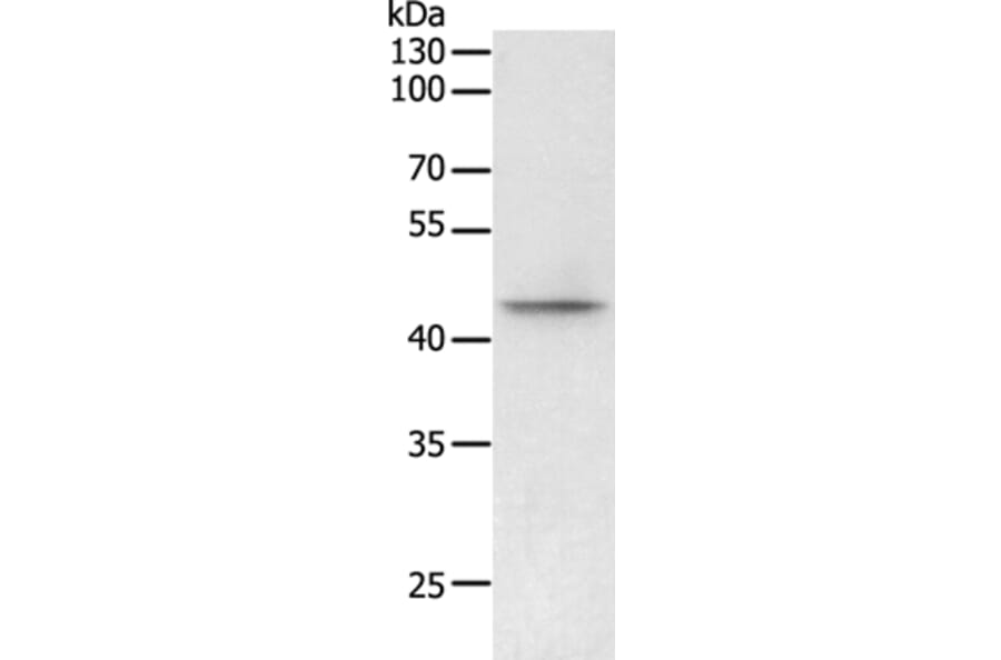 PHF6 Antibody from Signalway Antibody (35894) - Antibodies.com