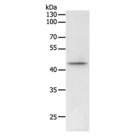 PHF6 Antibody from Signalway Antibody (35894) - Antibodies.com