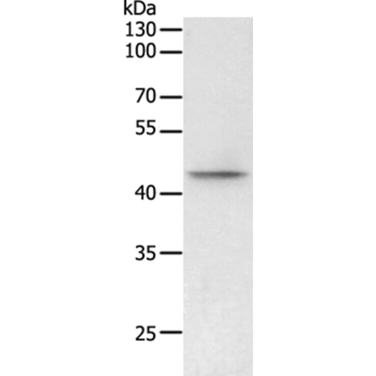 PHF6 Antibody from Signalway Antibody (35894) - Antibodies.com
