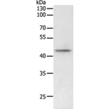 PHF6 Antibody from Signalway Antibody (35894) - Antibodies.com