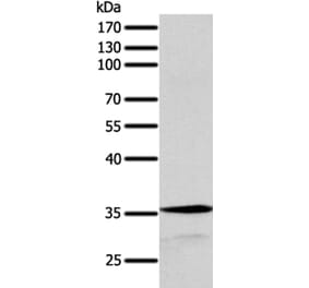 SYT9 Antibody from Signalway Antibody (35939) - Antibodies.com