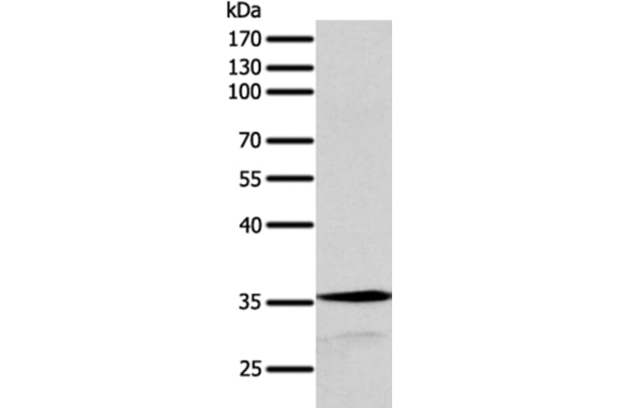 SYT9 Antibody from Signalway Antibody (35939) - Antibodies.com