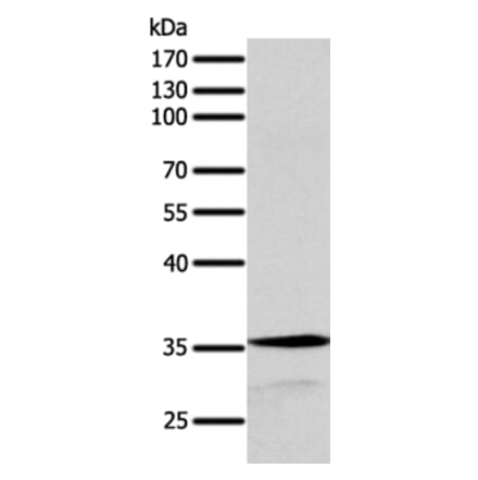 SYT9 Antibody from Signalway Antibody (35939) - Antibodies.com