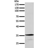SYT9 Antibody from Signalway Antibody (35939) - Antibodies.com
