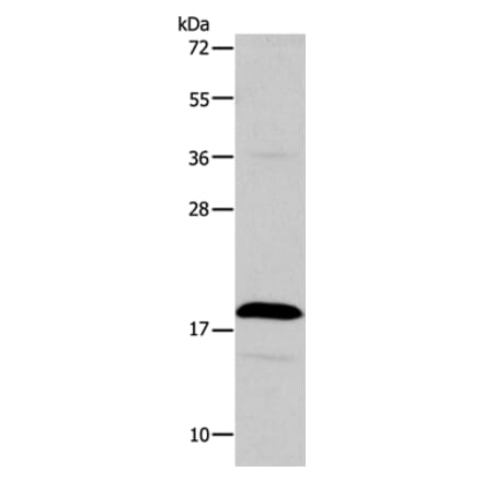 TSLP Antibody from Signalway Antibody (35981) - Antibodies.com