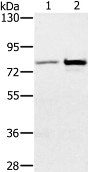 Gel: 6%SDS-PAGE Lysates (from left to right): Human testis tissue and K562 cell Amount of lysate: 40ug per lane Primary antibody: 1/300 dilution Secondary antibody dilution: 1/8000 Exposure time: 2 minutes