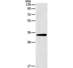 GNMT Antibody from Signalway Antibody (36146) - Antibodies.com