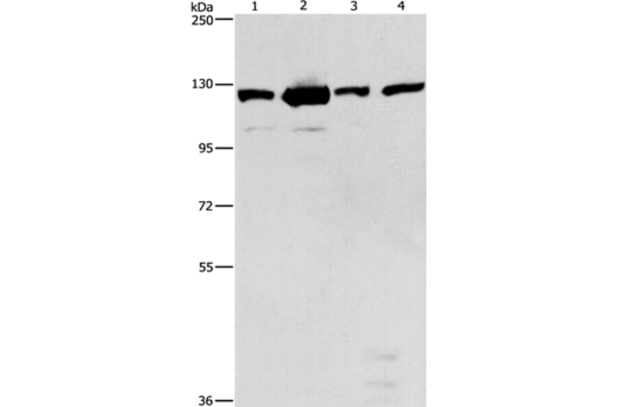 PTK2 Antibody from Signalway Antibody (36214) - Antibodies.com