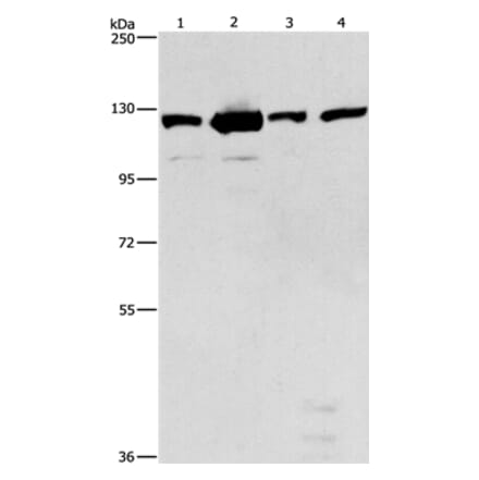 PTK2 Antibody from Signalway Antibody (36214) - Antibodies.com