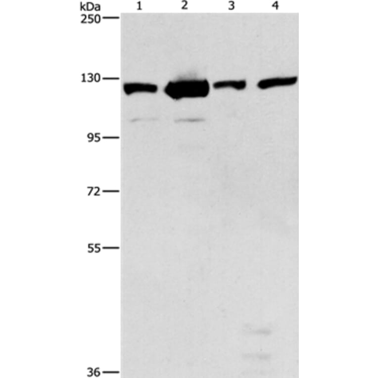 PTK2 Antibody from Signalway Antibody (36214) - Antibodies.com