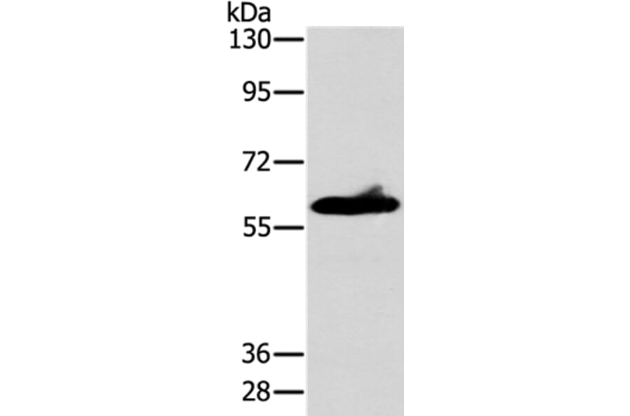 ASB3 Antibody from Signalway Antibody (36264) - Antibodies.com