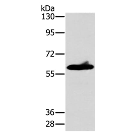 ASB3 Antibody from Signalway Antibody (36264) - Antibodies.com