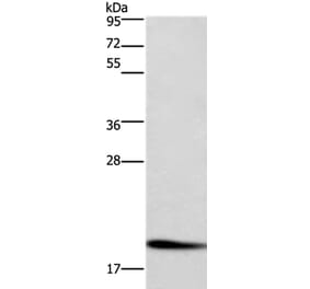 CFL1 Antibody from Signalway Antibody (36360) - Antibodies.com