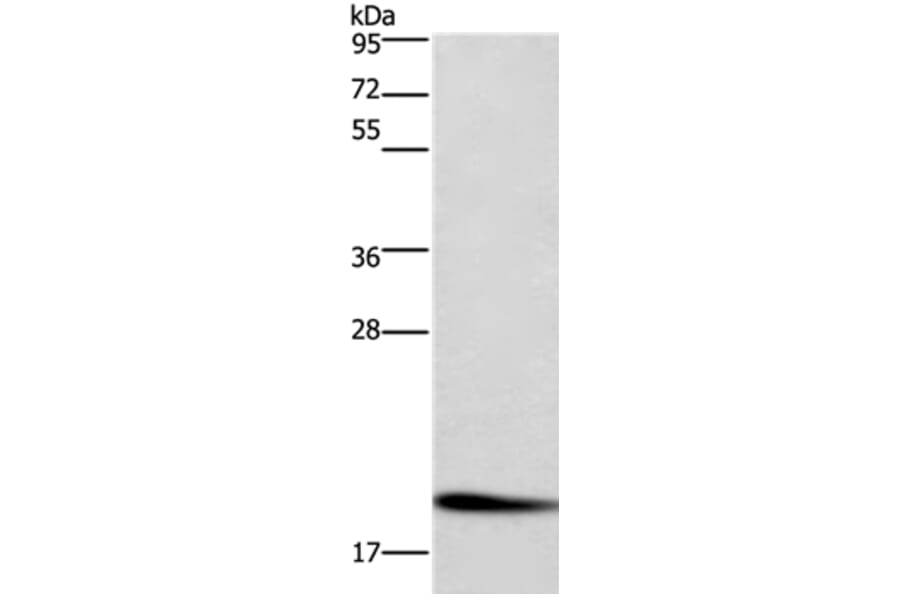 CFL1 Antibody from Signalway Antibody (36360) - Antibodies.com
