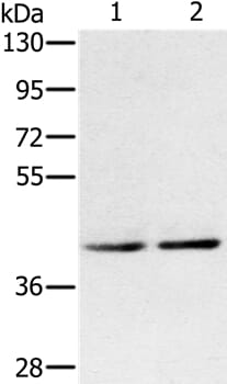 Gel: 8% SDS-PAGE Lysates (from left to right): K562 and Jurkat cell Amount of lysate: 40ug per lane Primary antibody: 1/400 dilution Secondary antibody dilution: 1/8000 Exposure time: 1 minute