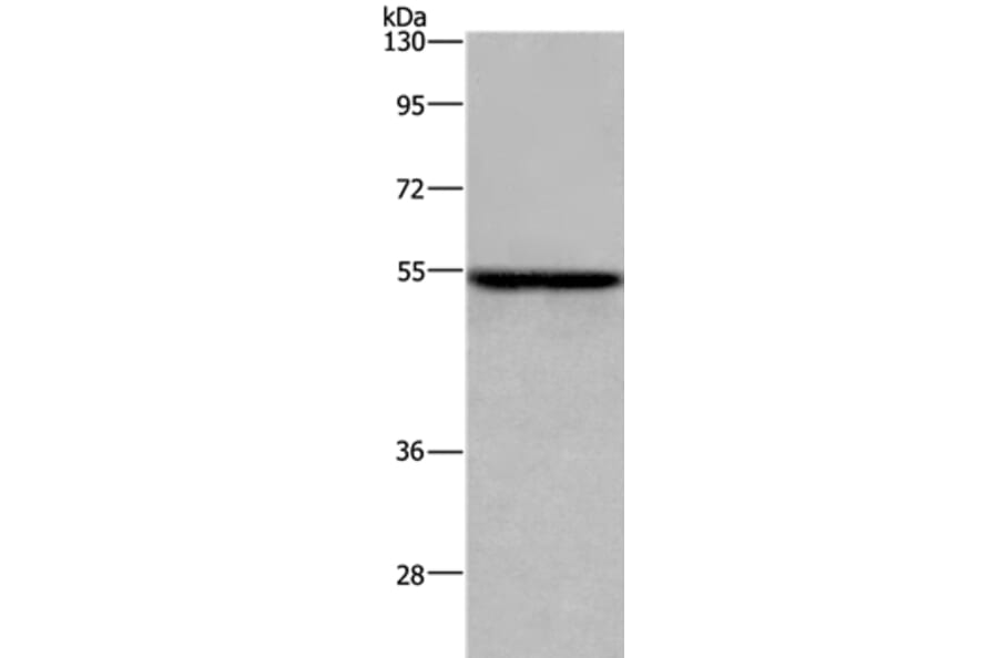 ETS2 Antibody from Signalway Antibody (36451) - Antibodies.com