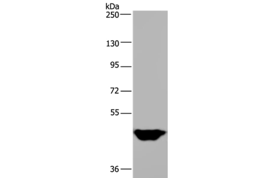 MTF2 Antibody from Signalway Antibody (36623) - Antibodies.com