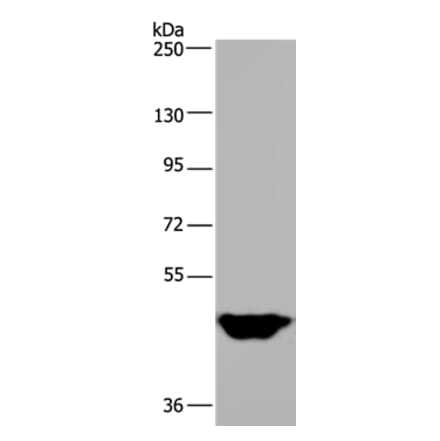 MTF2 Antibody from Signalway Antibody (36623) - Antibodies.com
