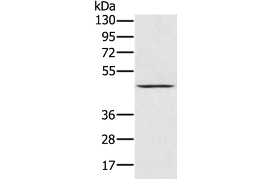 PRR5 Antibody from Signalway Antibody (36702) - Antibodies.com