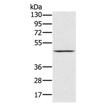 PRR5 Antibody from Signalway Antibody (36702) - Antibodies.com