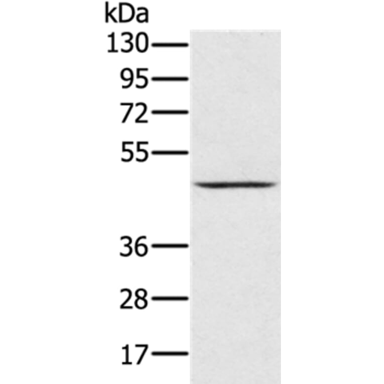 PRR5 Antibody from Signalway Antibody (36702) - Antibodies.com
