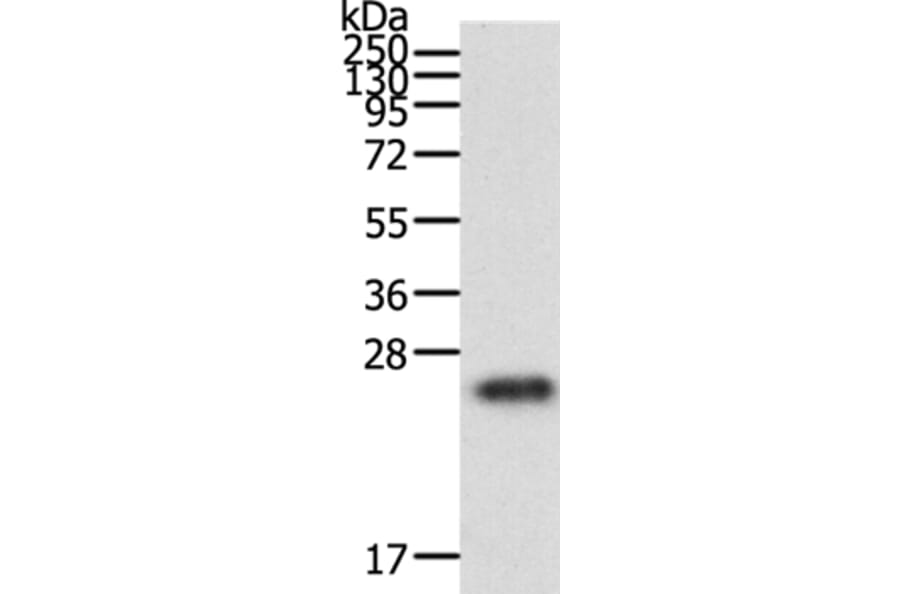 RAC1 Antibody from Signalway Antibody (36742) - Antibodies.com