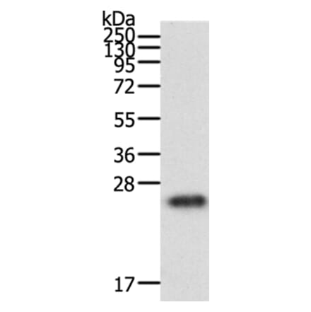 RAC1 Antibody from Signalway Antibody (36742) - Antibodies.com