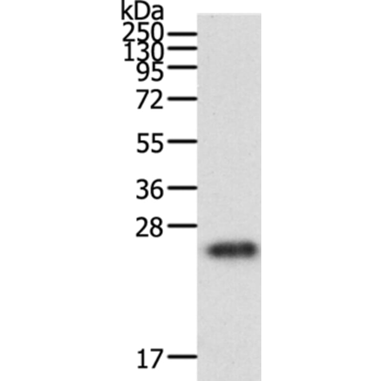 RAC1 Antibody from Signalway Antibody (36742) - Antibodies.com
