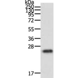 RAC1 Antibody from Signalway Antibody (36742) - Antibodies.com