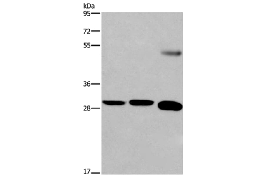 FGF8 Antibody from Signalway Antibody (36773) - Antibodies.com