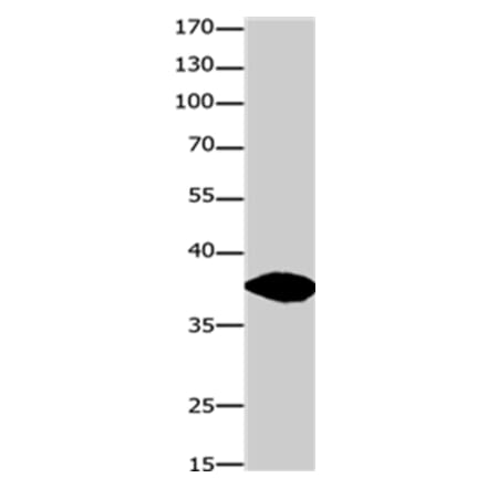 GJD2 Antibody from Signalway Antibody (36809) - Antibodies.com