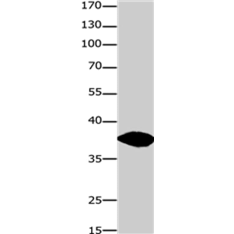 GJD2 Antibody from Signalway Antibody (36809) - Antibodies.com