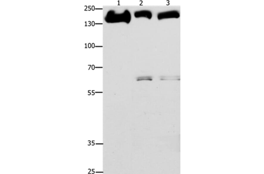 EGFR Antibody from Signalway Antibody (36836) - Antibodies.com