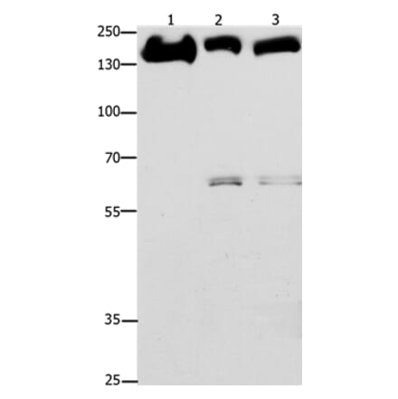 EGFR Antibody from Signalway Antibody (36836) - Antibodies.com