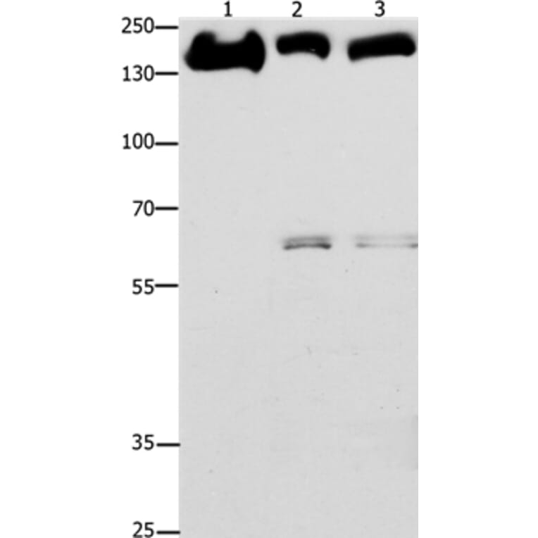 EGFR Antibody from Signalway Antibody (36836) - Antibodies.com