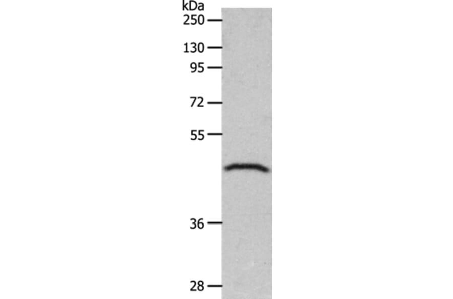GDF1 Antibody from Signalway Antibody (36898) - Antibodies.com