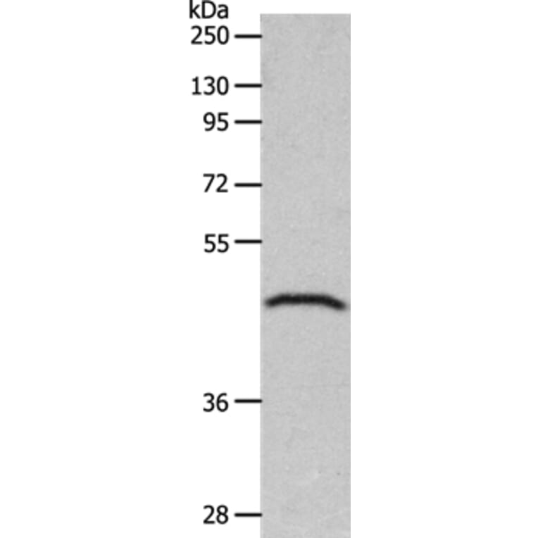 GDF1 Antibody from Signalway Antibody (36898) - Antibodies.com