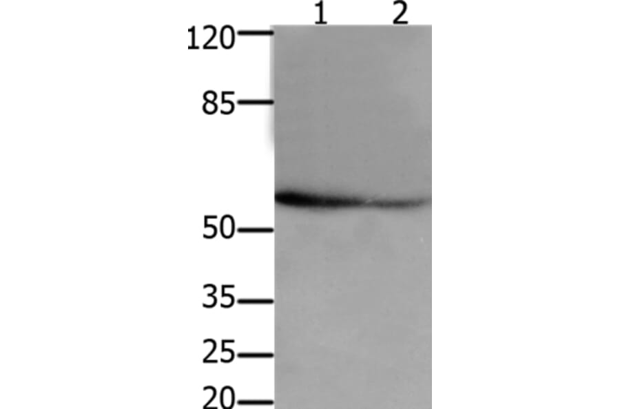 API5 Antibody from Signalway Antibody (36927) - Antibodies.com