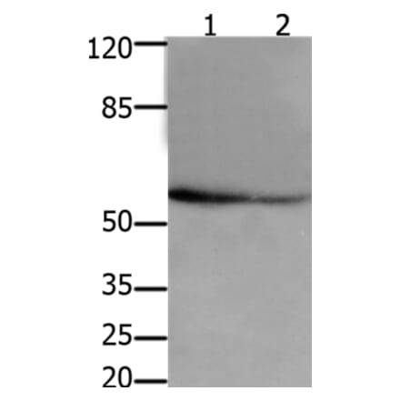 API5 Antibody from Signalway Antibody (36927) - Antibodies.com