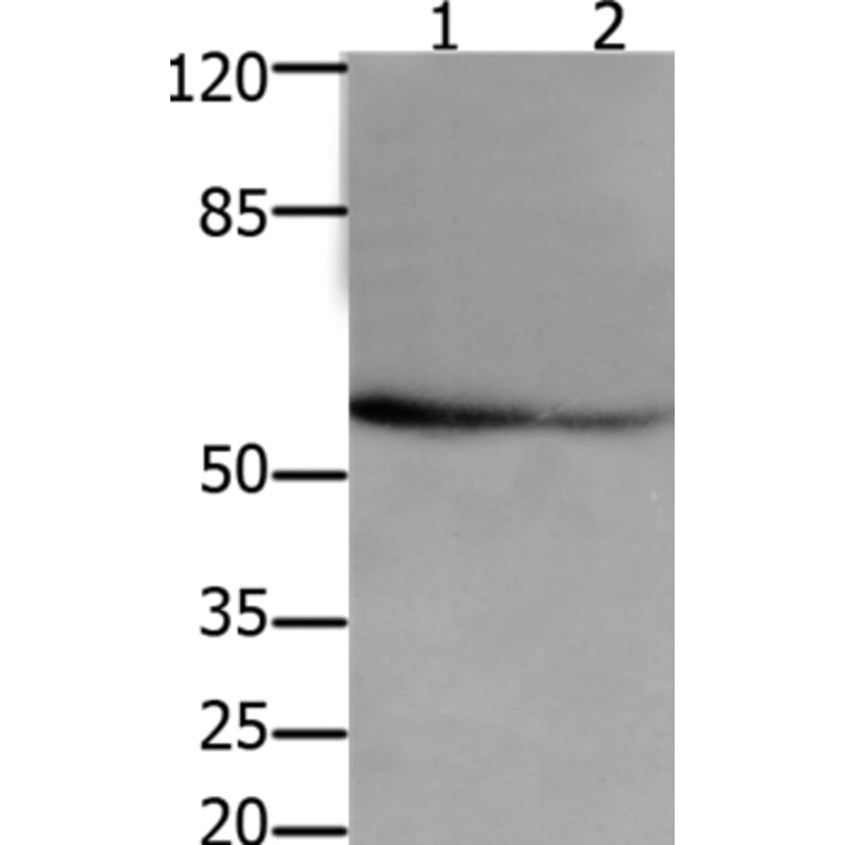 API5 Antibody from Signalway Antibody (36927) - Antibodies.com